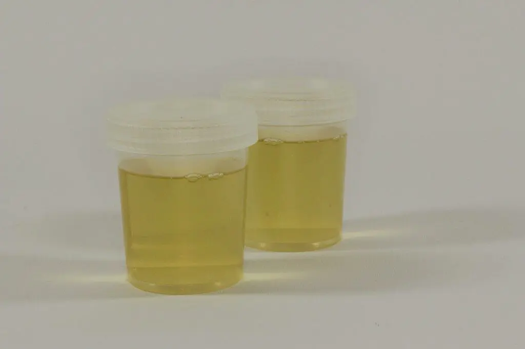 Urine test for urinary tract infections