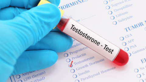 Doctor holding a testosterone level test