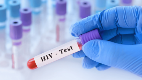 HIV test after being exposed to HIV|