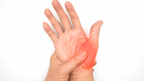 Cellulitis on hand