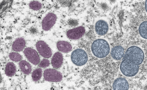 monkeypox virus under microscope