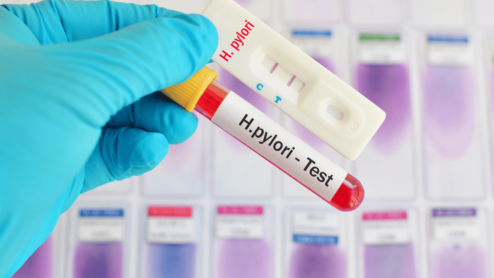 H. Pylori test